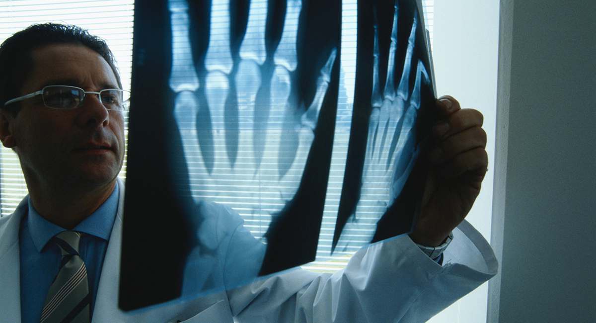 I Got A Hand Transplant 5 Horrifying Realities