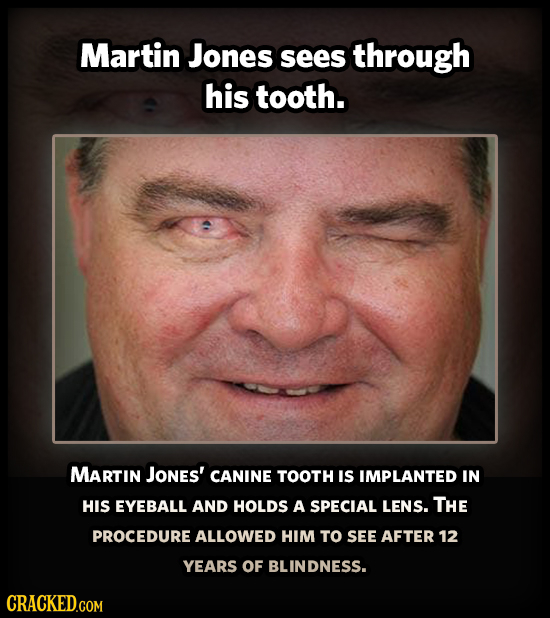 22 Weird Medical Facts That’ll Bring Conversations To A Halt