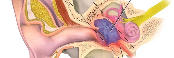 People Think You're A Dick: 5 Facts About Hearing Problems