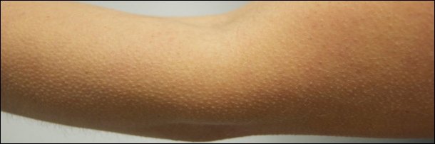 The 5 Strangest Things Evolution Left In Your Body