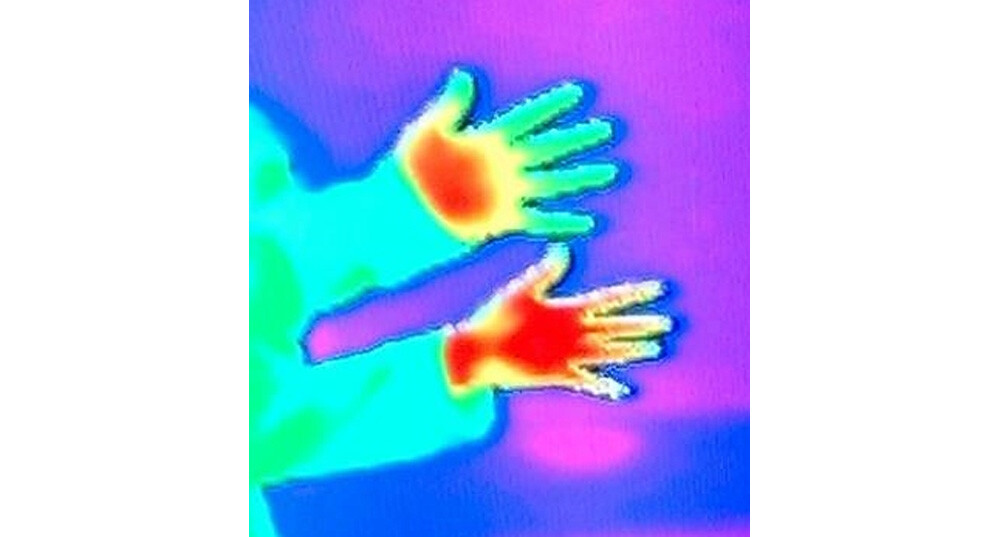 A thermal image demonstrating the loss of heat in a Reynaud's sufferer