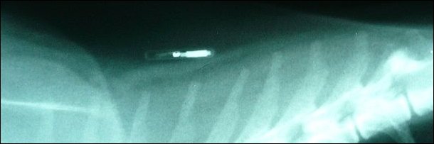 5 Tiny Technologies That Will Doom Us (From The Inside Out)