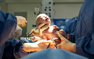 5 Things You Learn From A Miraculous, Nightmarish Childbirth