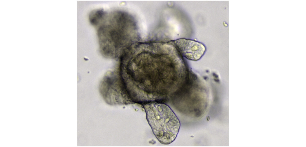 Intestinal organoid