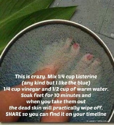 This is crazy. Mix 1/4 cup Listerine (any kind but I like the blue) 1/4 cup vinegar and 1/2 cup of warm water. Soak feet for 10 minutes and when you t