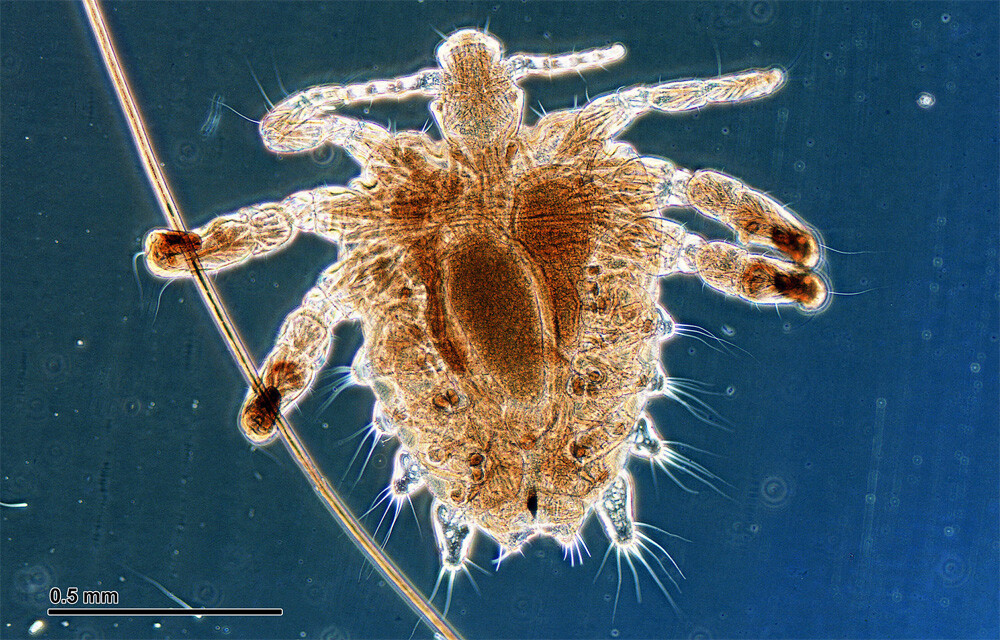 Crab louse Female, from a human host