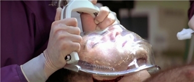 Face/Off face surgery