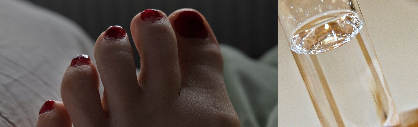 We Started Studying Anesthesia After Toenail Surgery Went Horribly Wrong