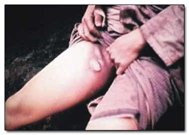 5 Great Things You Didn't Know Came from Horrific Tragedies