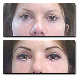 The 7 Most Pointlessly Horrifying Plastic Surgery Procedures