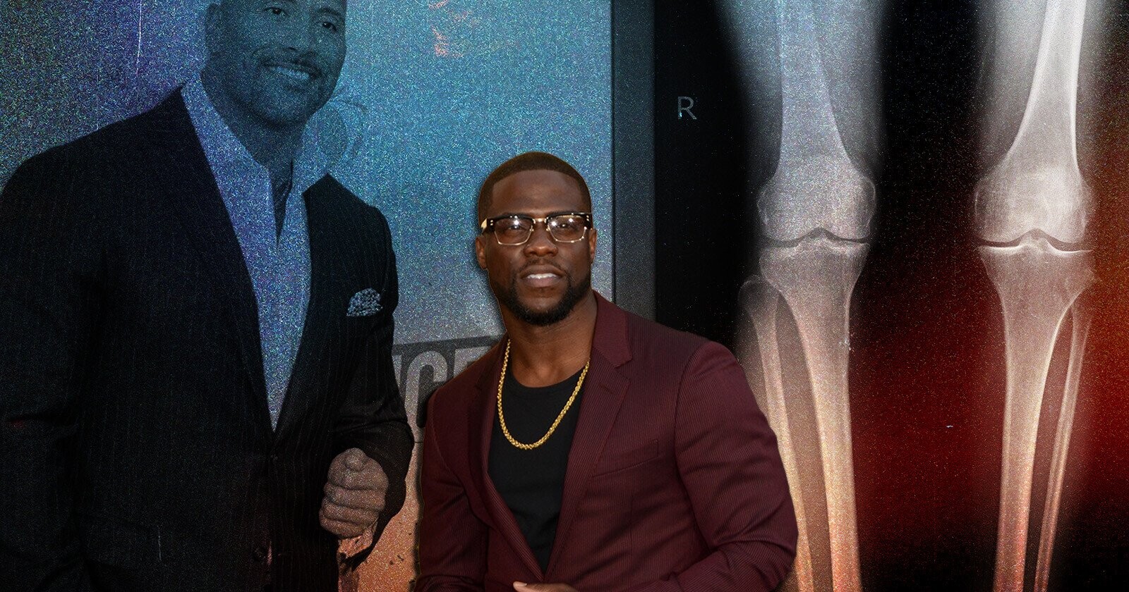 Height Challenged Kevin Hart Says ‘Hell No!’ to Leg-Lengthening Surgery ...