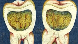People Used To Blame Cavities On Evil Tooth Worms