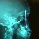 CRACKED ROUND-UP: Love is Terrible Edition