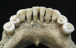 How A Dead Nun Ended Up With Teeth Full Of Treasure