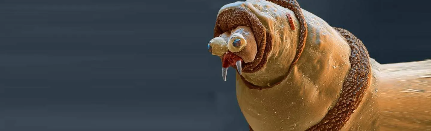 12 Things You'll Wish You'd Never Seen Under a Microscope