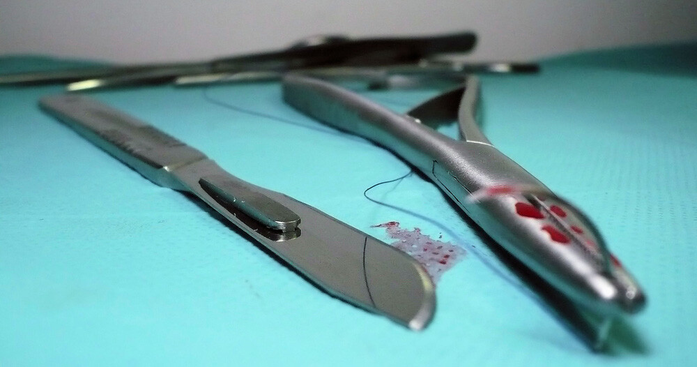 5 Medical Procedures From 30 Years Ago (That Now Seem Barbaric) - bloody forceps and a scalpel