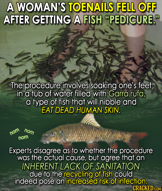A WOMAN'S TOENAILS FELL OFF AFTER GETTING A FISH PEDICURE. The procedure involves soaking one's feet in a tub of water filled with Garra rufa, a typ
