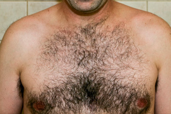 Чёрная жирная соска Чёрная жирная соска