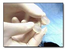 The 7 Most Pointlessly Horrifying Plastic Surgery Procedures