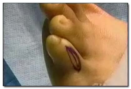 The 7 Most Pointlessly Horrifying Plastic Surgery Procedures