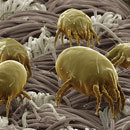 11 Everyday Things That Are Terrifying Under a Microscope