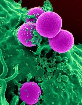 Hitler's Super Jet: 6 Lost Historical Secrets We've Dug Up