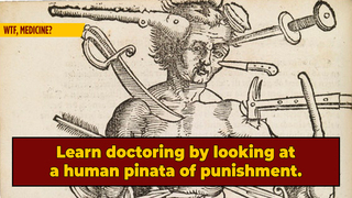 Meet 'Wound Man,' The IKEA Instruction Manual Of Medieval Surgery