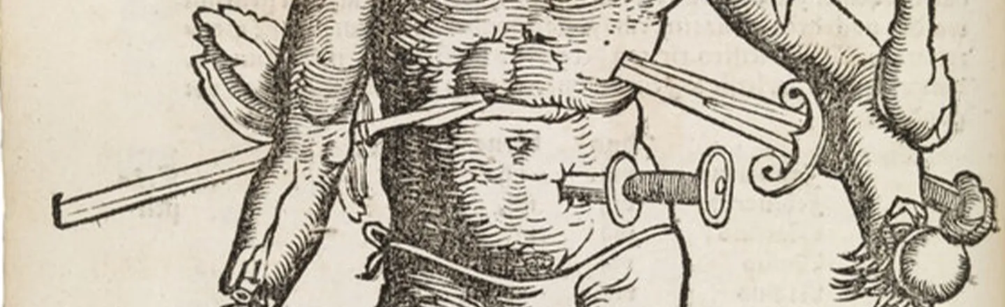 Meet 'Wound Man,' The IKEA Instruction Manual Of Medieval Surgery