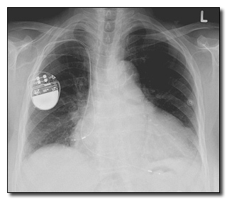 8 Things You Won't Believe Can Be Hacked