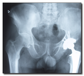 8 Things You Won't Believe Can Be Hacked