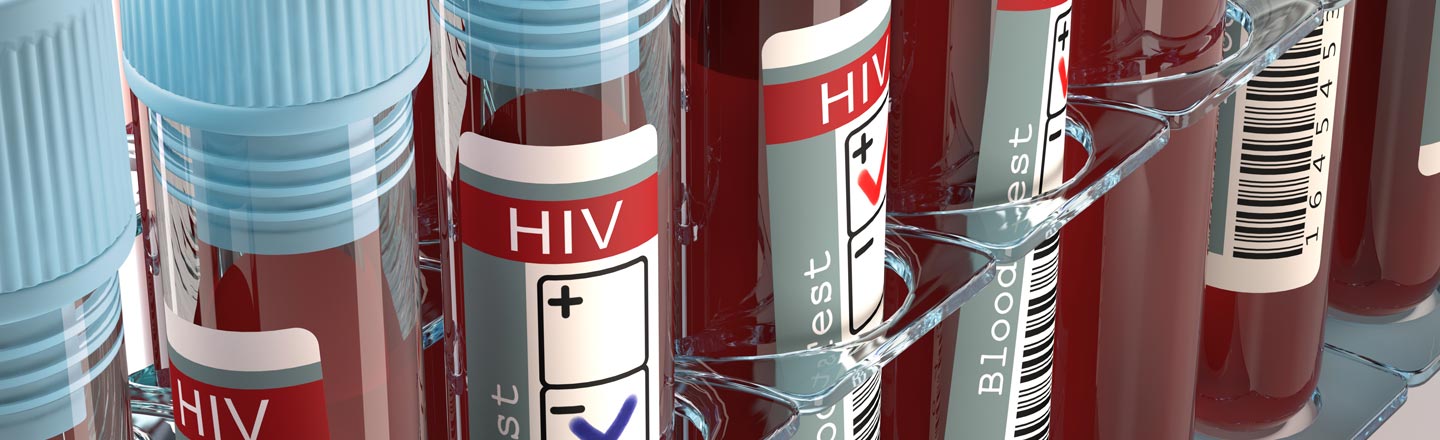 GOOD Virus News: TWO People Have Been Cured Of HIV