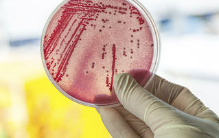 6 Objective Reasons Why Your Fear of Bacteria Is Irrational