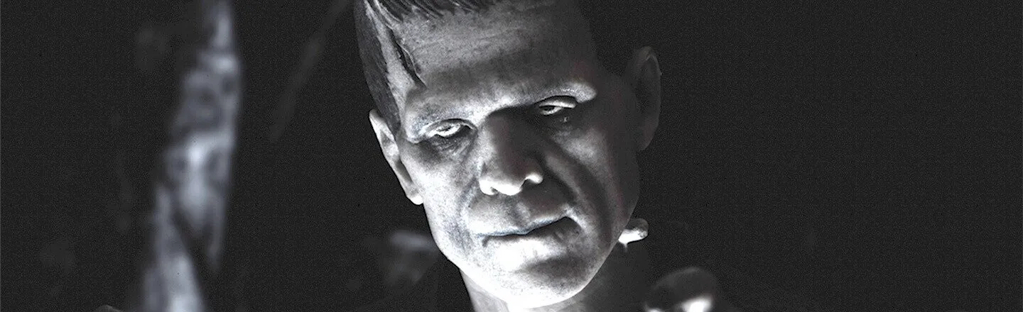 5 Real Surgical Operations Worthy of Frankenstein’s Lab