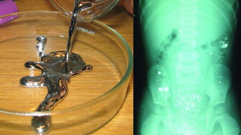 Chugging A Pound Of Mercury Is Fine, It Seems