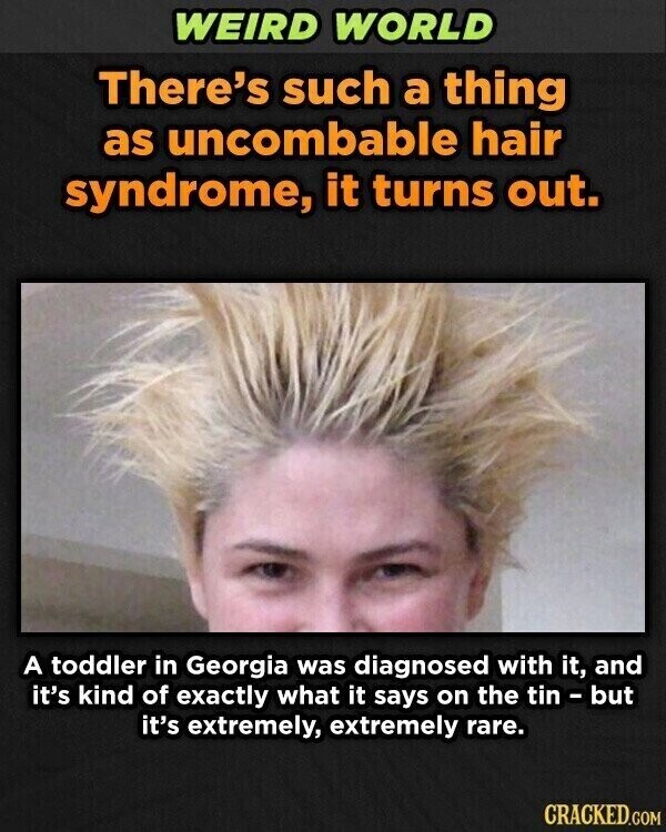 WEIRD WORLD There's such a thing as uncombable hair syndrome, it turns out. A toddler in Georgia was diagnosed with it, and it's kind of exactly what it says on the tin - but it's extremely, extremely rare. CRACKED.COM