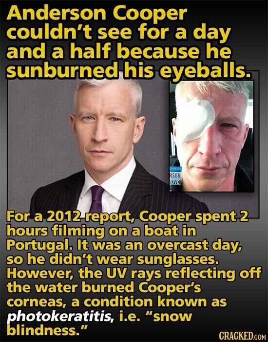 Anderson Cooper couldn't see for a day and a half because he sunburned his eyeballs. SONLIVE RSON LIVE For a 2012 report, Cooper spent 2 hours filming on a boat in Portugal. It was an overcast day, so he didn't wear sunglasses. However, the UV rays reflecting off the water burned Cooper's corneas, a condition known as photokeratitis, i.e. snow blindness. CRACKED.COM