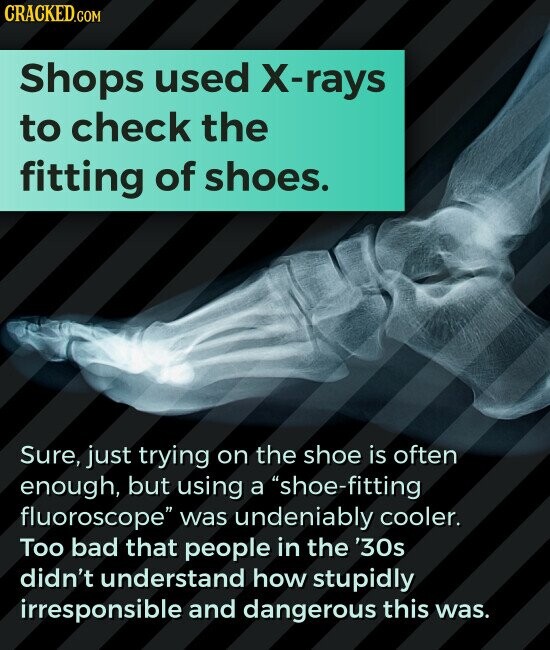 CRACKED.COM Shops used X-rays to check the fitting of shoes. Sure, just trying on the shoe is often enough, but using a shoe-fitting fluoroscope was undeniably cooler. Too bad that people in the '30s didn't understand how stupidly irresponsible and dangerous this was.