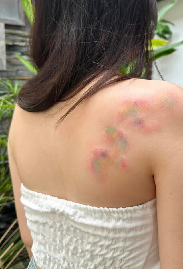 Tattoos That Should Be Removed for Everyone's Sake