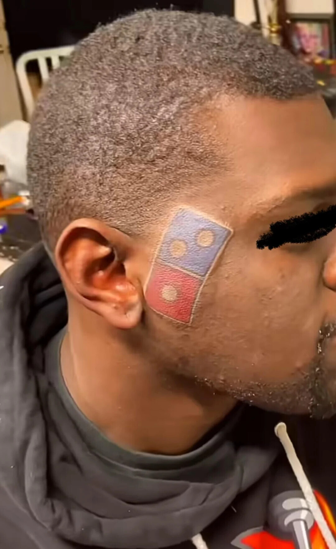 Tattoos That Should Be Removed for Everyone's Sake