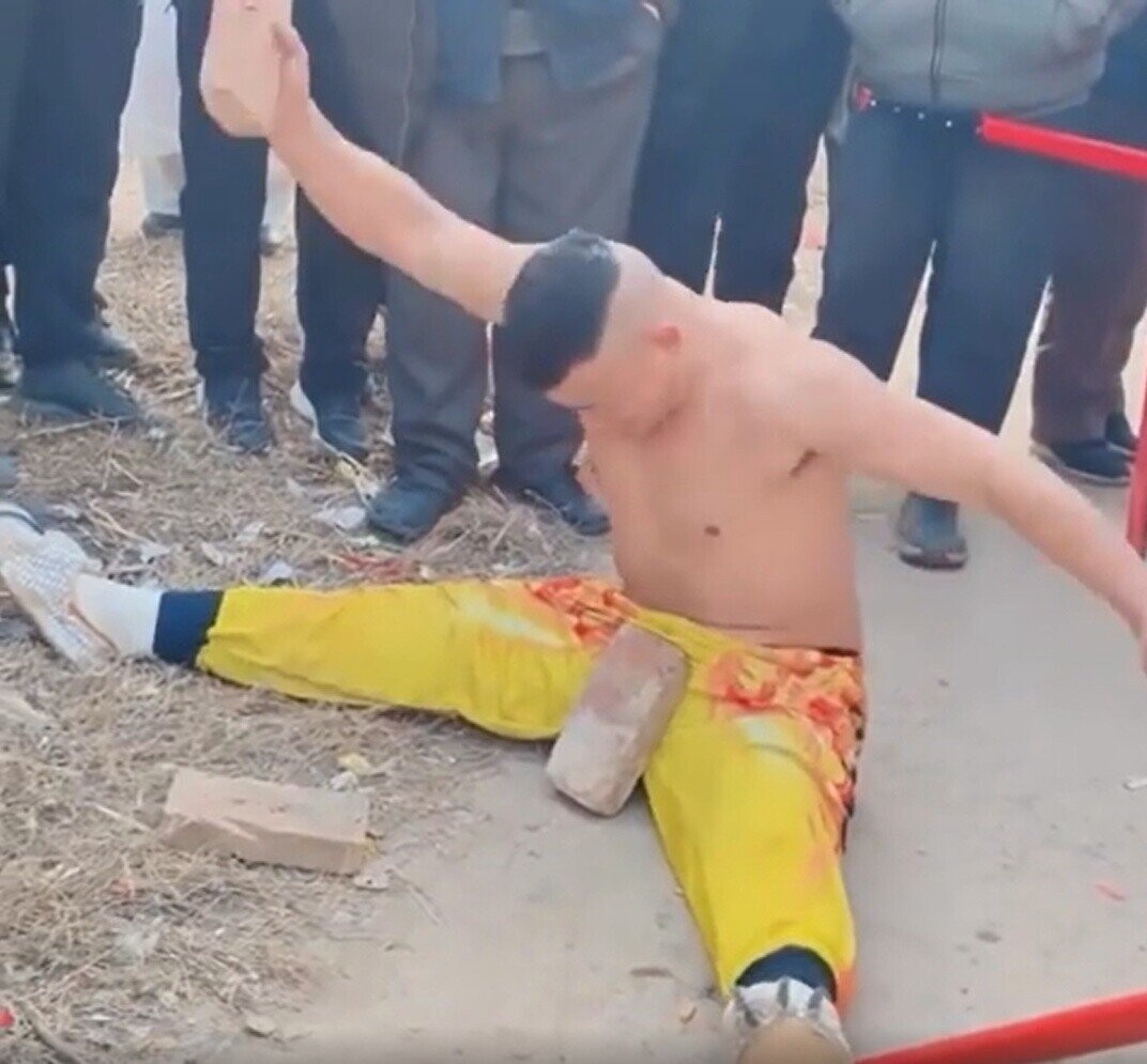 Photos Where Intervention Was Desperately Needed