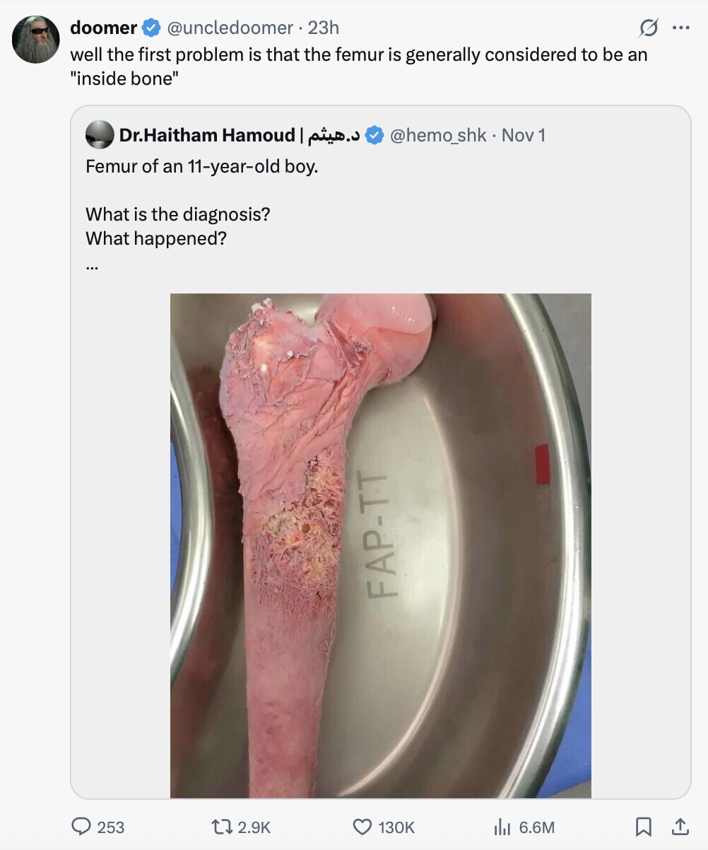 doomer @uncledoomer.23h G ... well the first problem is that the femur is generally considered to be an inside bone Dr.Haitham Hamoud د.هيثم @hemo_shk - Nov 1 Femur of an 11-year-old boy. What is the diagnosis? What happened? FAP-TT 253 2.9K 130K 6.6M 