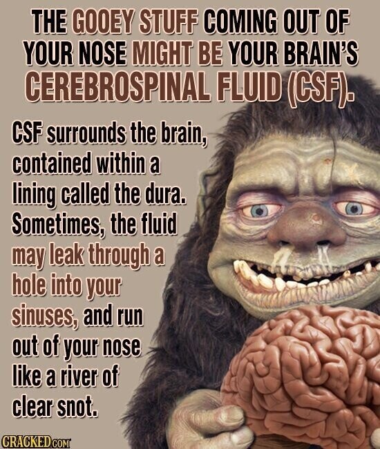 THE GOOEY STUFF COMING OUT OF YOUR NOSE MIGHT BE YOUR BRAIN'S CEREBROSPINAL FLUID (CSF). CSF surrounds the brain, contained within a lining called the dura. Sometimes, the fluid may leak through a hole into your sinuses, and run out of your nose like a river of clear snot. CRACKED.COM