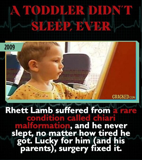 A TODDLER DIDN'T SLEEP EVER 2009 Rhett Lamb suffered from a rare condition called chiari malformation, and he never slept, no matter how tired he got. Lucky for him (and his parents), surgery fixed it.