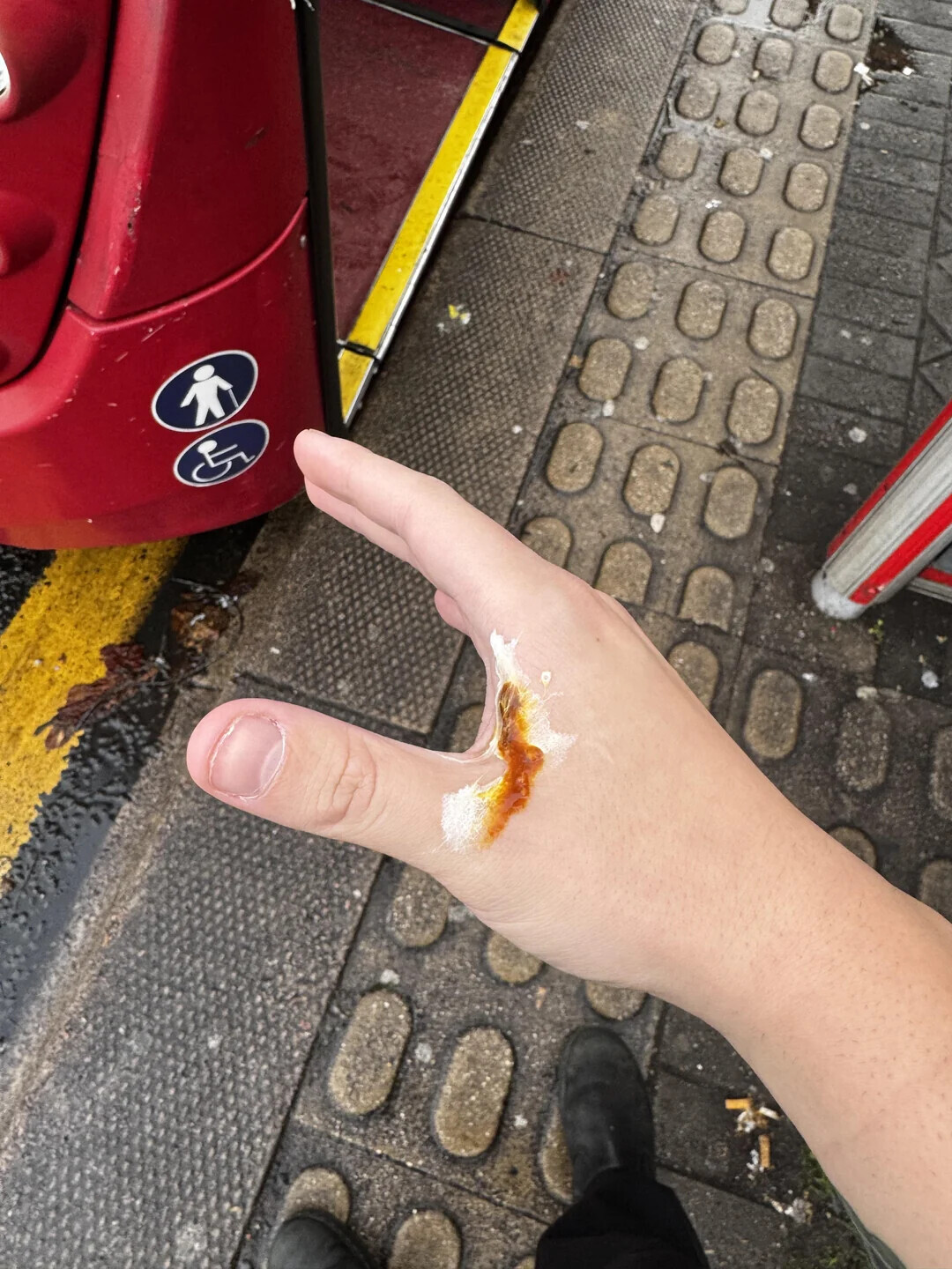 Photos Where the Less Fortunate Get Especially Unlucky