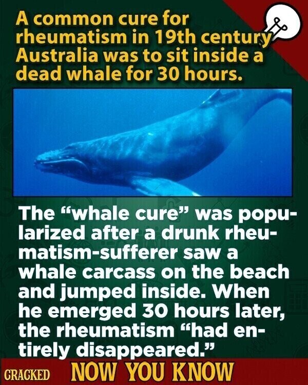 A common cure for rheumatism in 19th century Australia was to sit inside a dead whale for 30 hours. The whale cure was popu- larized after a drunk rheu- matism-sufferer saw a whale carcass on the beach and jumped inside. When he emerged 30 hours later, the rheumatism had en- tirely disappeared. CRACKED NOW YOU KNOW