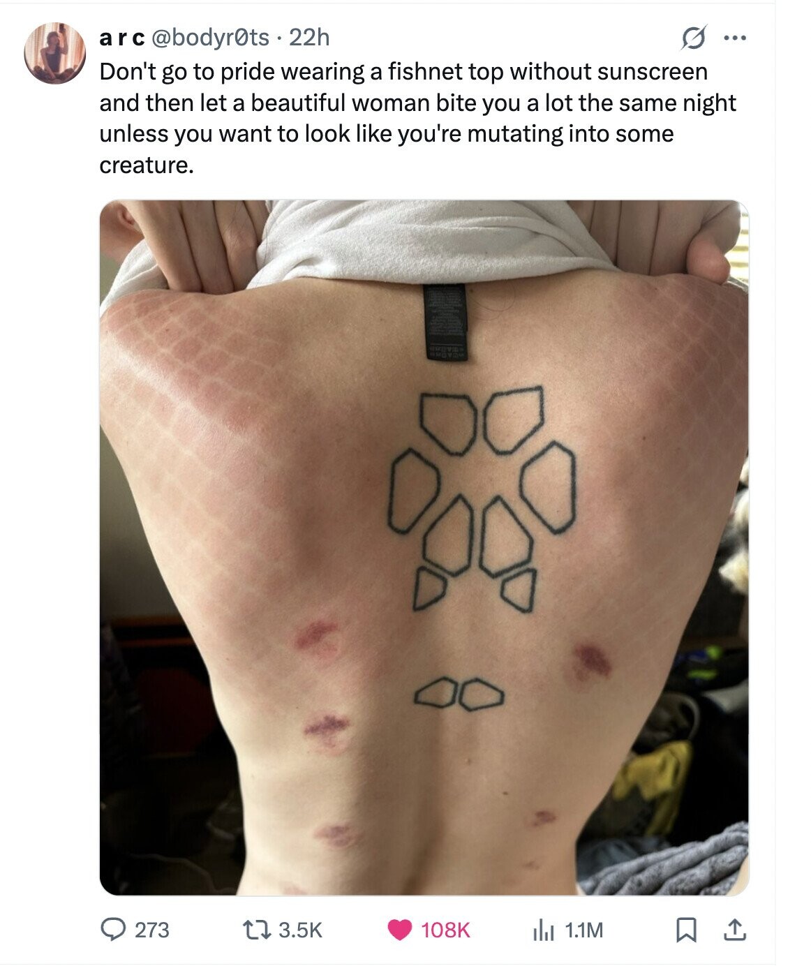 arc @bodyr@ts . 22h O ... Don't go to pride wearing a fishnet top without sunscreen and then let a beautiful woman bite you a lot the same night unless you want to look like you're mutating into some creature. 273 3.5K 108K 1.1M