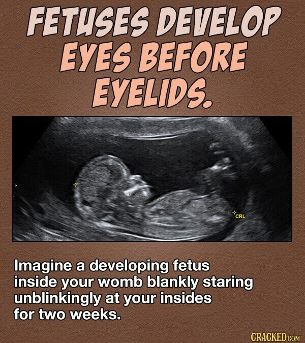 FETUSES DEVELOP EYES BEFORE EYELIDS. CRL Imagine a developing fetus inside your womb blankly staring unblinkingly at your insides for two weeks. CRACKED COM
