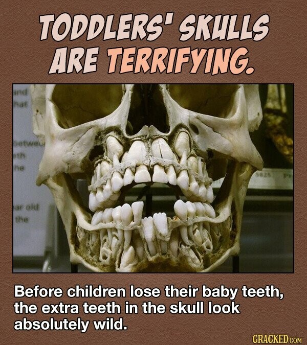 TODDLERS' SKULLS ARE TERRIFYING. and hat betweu ath he 5825 ar old the Before children lose their baby teeth, the extra teeth in the skull look absolutely wild. CRACKED COM