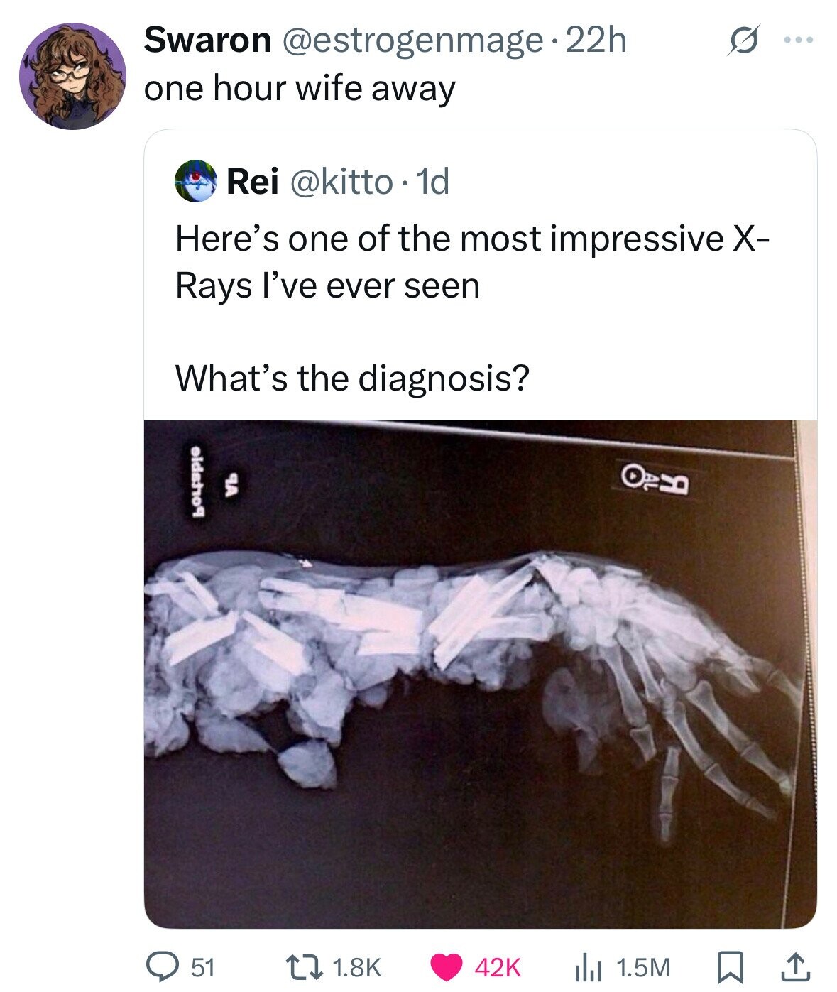 Swaron @estrogenmage- 22h ... one hour wife away Rei @kitto . 1d Here's one of the most impressive X- Rays I've ever seen What's the diagnosis? eidsho9 9A لاحة 51 1.8K 42K 1.5M 