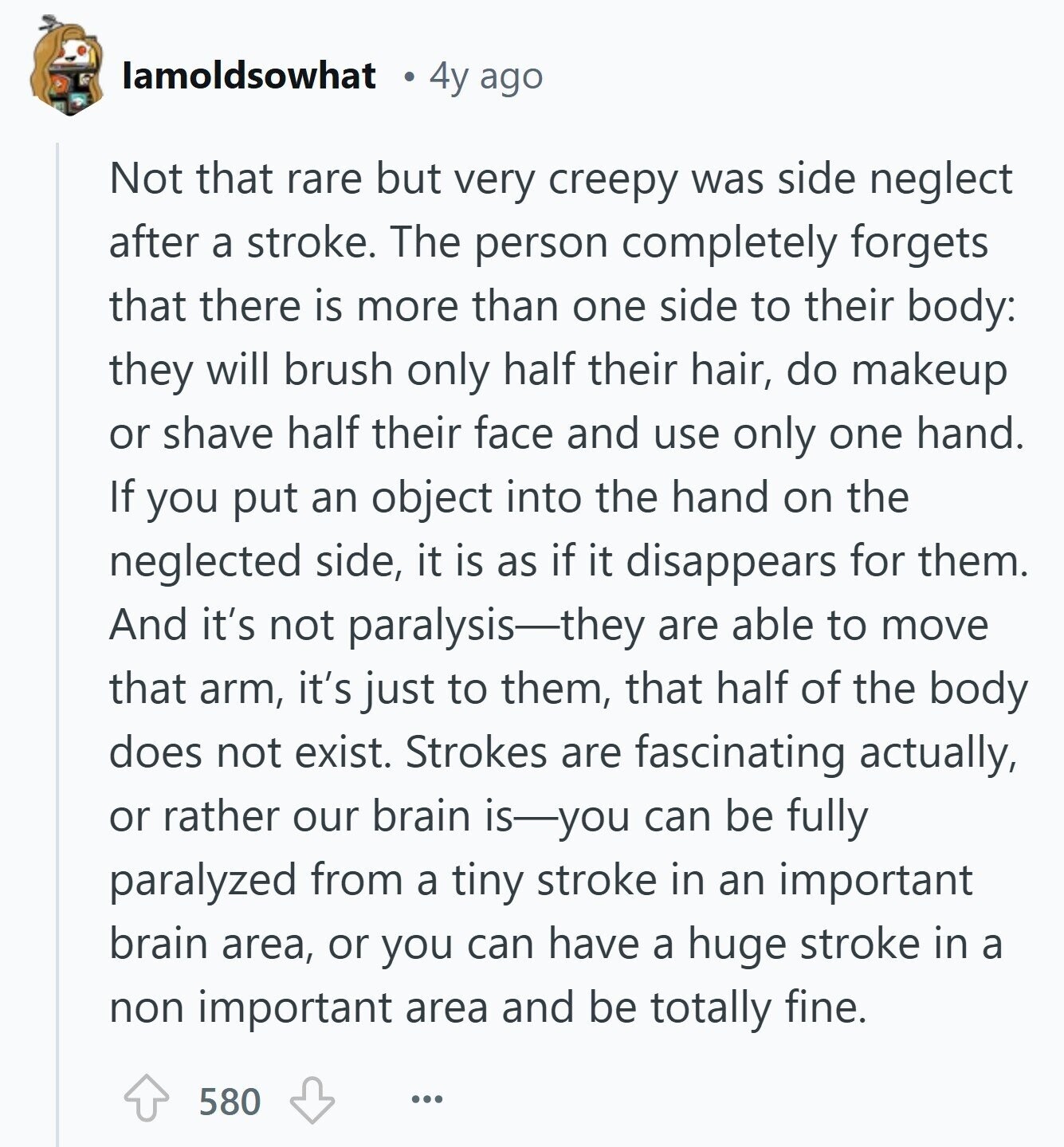 lamoldsowhat 4y ago Not that rare but very creepy was side neglect after a stroke. The person completely forgets that there is more than one side to their body: they will brush only half their hair, do makeup or shave half their face and use only one hand. If you put an object into the hand on the neglected side, it is as if it disappears for them. And it's not paralysis-they are able to move that arm, it's just to them, that half of the body does not exist. Strokes are fascinating actually, or rather our brain is-you can 